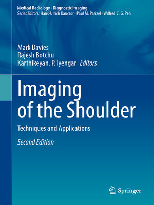 cover image of Imaging of the Shoulder